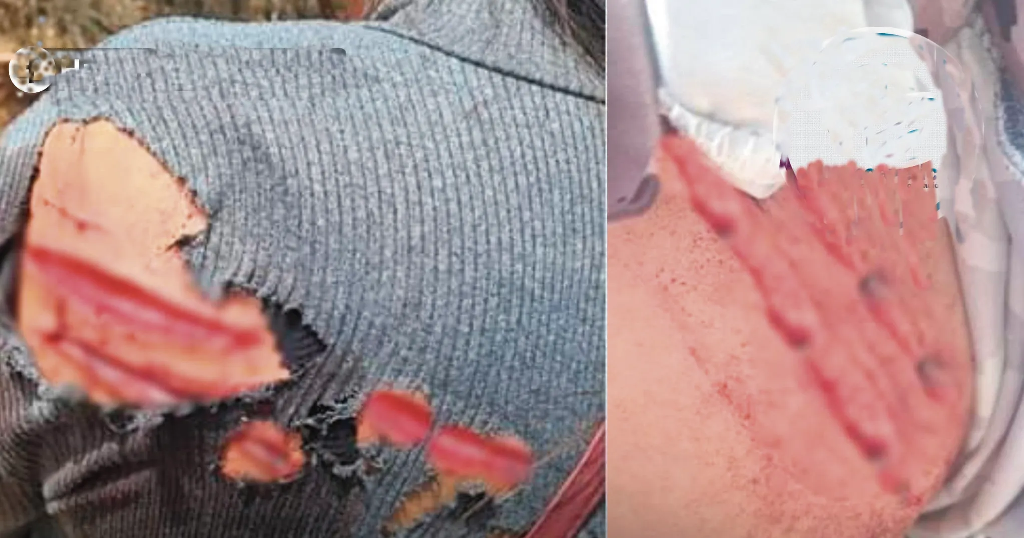 LAS VÍCTIMAS SON DOS SEÑORITAS: DENUNCIAN INTENTO DE FEMINICIDIO EN PAMPAS
