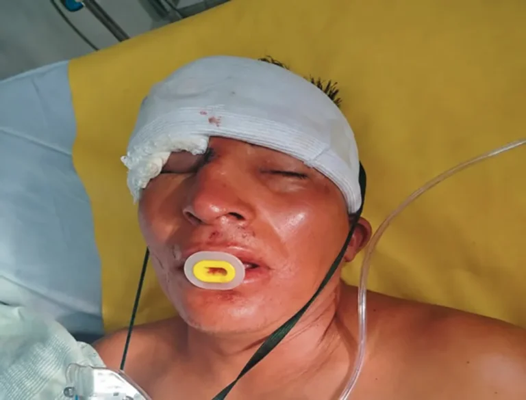 PIDEN AYUDA: PARA IDENTIFICAR A HOMBRE ATROPELLADO EN SINCOS- JAUJA