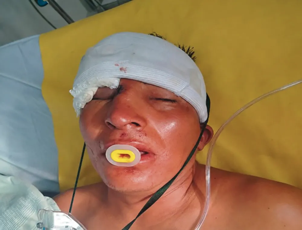 PIDEN AYUDA: PARA IDENTIFICAR A HOMBRE ATROPELLADO EN SINCOS- JAUJA