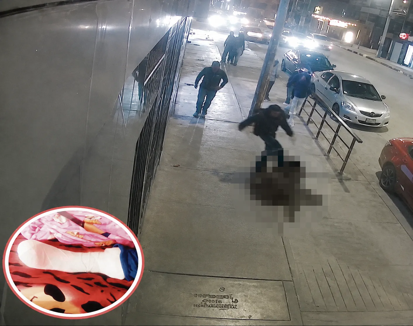 VIOLENCIA DE GÉNERO: SUJETO FRACTURA LA PIERNA A SU EXPAREJA