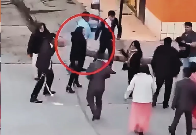 CHAUPIMARCA: MUJER TERMINA CON EL ROSTRO DESFIGURADO