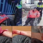 ADULTO MAYOR: QUEDA EN ESTADO CRÍTICO TRAS SUFRIR PROFUNDO CORTE EN EL BRAZO