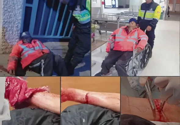 ADULTO MAYOR: QUEDA EN ESTADO CRÍTICO TRAS SUFRIR PROFUNDO CORTE EN EL BRAZO